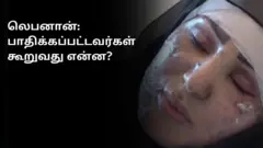 "என் அருகிலேயே தந்தை கொல்லப்பட்டார்" - லெபனான் மருத்துவமனை எப்படி இருக்கிறது?