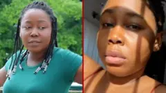 skin bleaching