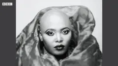 alopecie