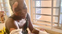 Di fire burn her hands and some part of her head