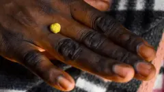 شخص يضع معدنا نفيسا على أصابعه