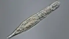 பிடெல்லாய்டு ரோட்டிஃபர் (Bdelloid Rotifer)