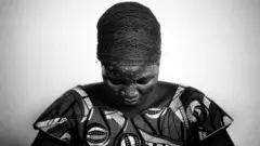 Woman wit monkeypox siddon