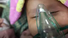 pneumonia