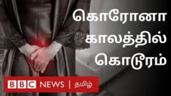 கொரோனா தடுப்பூசி போடுவதாக சிறுமிகளுக்கு பெண்ணுறுப்பு சிதைப்பு