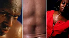 Oogun oju ati ara
