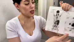 Fernanda Pereira com exames de imagem mostrando o câncer