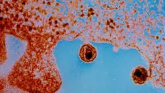 HIV