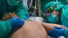 Medical team dealing with a patient in prone position
