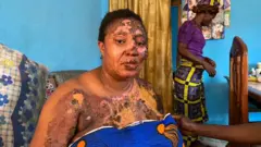 onye ọkụ kerosine gbara