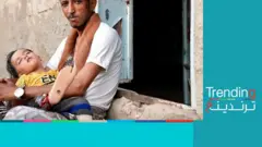 أطفال الحرب المنسيون في اليمن