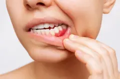 దంత వైద్యం 