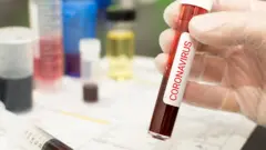 Teste de coronavírus