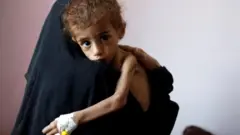 Yemen