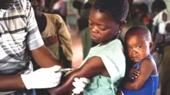 L'épidémie de rougeole en RDC est la plus grande au monde