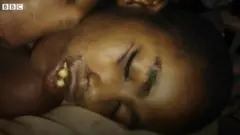 खल्वा