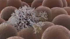 Célula cancerosa entre células normales