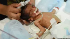 ਬੱਚਿਆਂ ’ਚ ਮੌਤ ਦੀ ਦਰ