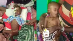 Daa'imman hanqina nyaataan miidhamanii Hospitaala Meeggaatti yaalamaa jiran