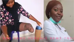 A medical Student with one leg