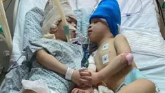 Bernardo and Arthur Lima after surgery