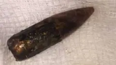शरीर से निकाली गई गोली