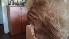 opadanje kose