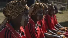 FGM