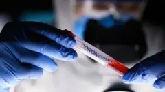 CORONVIRUS