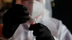 эмдөө