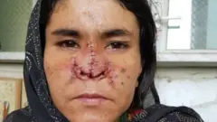 Zaarkaa ohospitaala osoo jirtuu