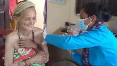 खोप