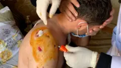 بينما يحتفل معظم الأذربيجانيين بنهاية القتال في ناغورنو كاراباخ، يكافح البعض للعودة إلى الحياة الطبيعية.