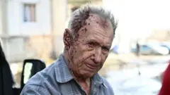 Chugúyev, herido