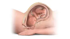 Ime afọ nwaanyị dị ime