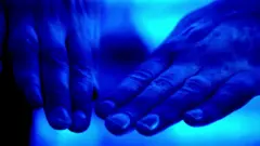 How germs spread