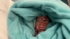 نوزائیدہ بچہ