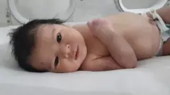 الطفلة آية.