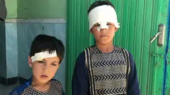 افغانستان، یکی از خطرناکترین کشورها برای کودکان