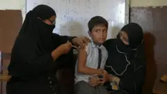 موفقیت واکسن جدید حصبه
