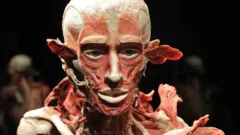 body world