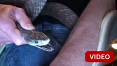 பாம்புக்கடி