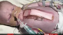 د زړه ناروغي