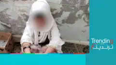 تعذيب طفلة يمنية بعمر 11 عاما على يد أهلها وبيعها كجارية