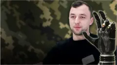 протез, ветеран