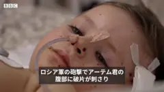 「プーチンの戦争」で負傷する子供たち　ウクライナ・マリウポリで砲撃され