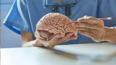 Médico segurando um cérebro
