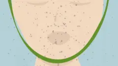 flu illustration