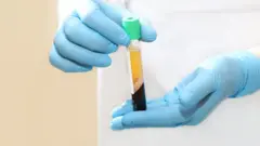 ਕੋਰੋਨਾ ਦਾ ਇਲਾਜ