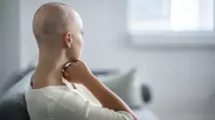Mujer sin pelo